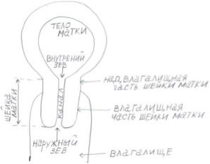 Запущенная эрозия шейки матки фото